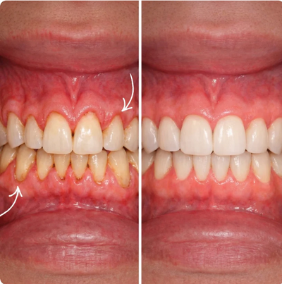 RunWell Gum