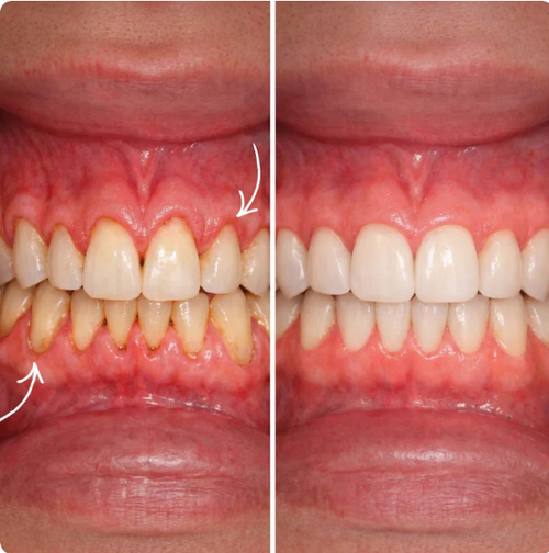 RunWell Gum